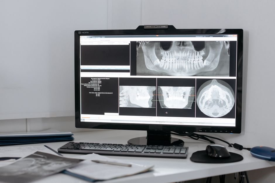 RadLE 2.0 : le benchmark qui révèle l’excès de confiance de l’IA en radiologie Écran de radiologie affichant une image médicale, illustration du benchmark RadLE 2.0